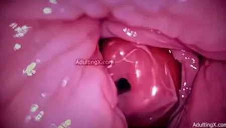 Camera In Vagina, Cervix Pov, Tiny Cucked By Giant Couple, Cum In Condom And Creampie - Full Clip