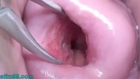 Japanese Wife Open Cervix Wide to watch inside Uterus