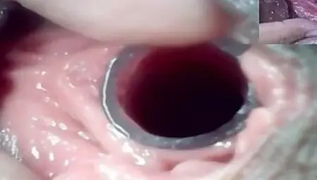 Lesbians Extreme Cervix Play and Peehole Fucking Penis Dildo