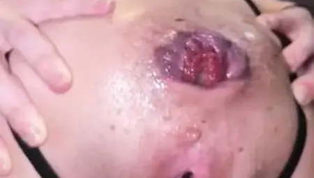 Anal Gaping and Prolapse Compilation!