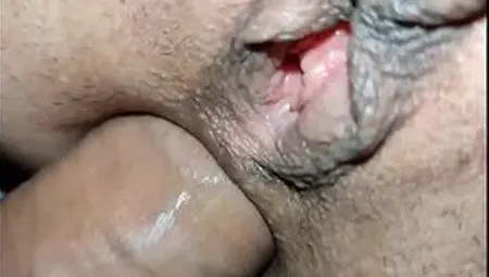 Milf's Stunning Anal&#x1F44C; Orifice