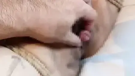 I Aspirate M Woman Clitoris and Am Fixed with Rubber