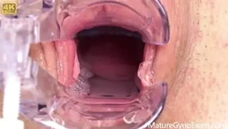 Shy Mature Woman's Cervix Explored!